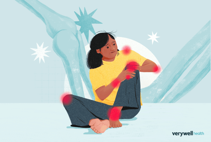 Rheumatoid arthritis treatment